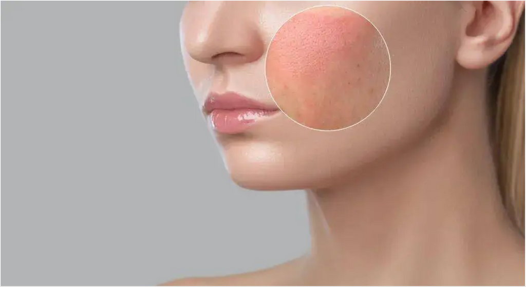 Understanding the Skin Barrier and How to Protect It