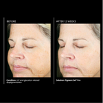 Pigment Gel Pro