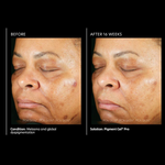 Pigment Gel Pro