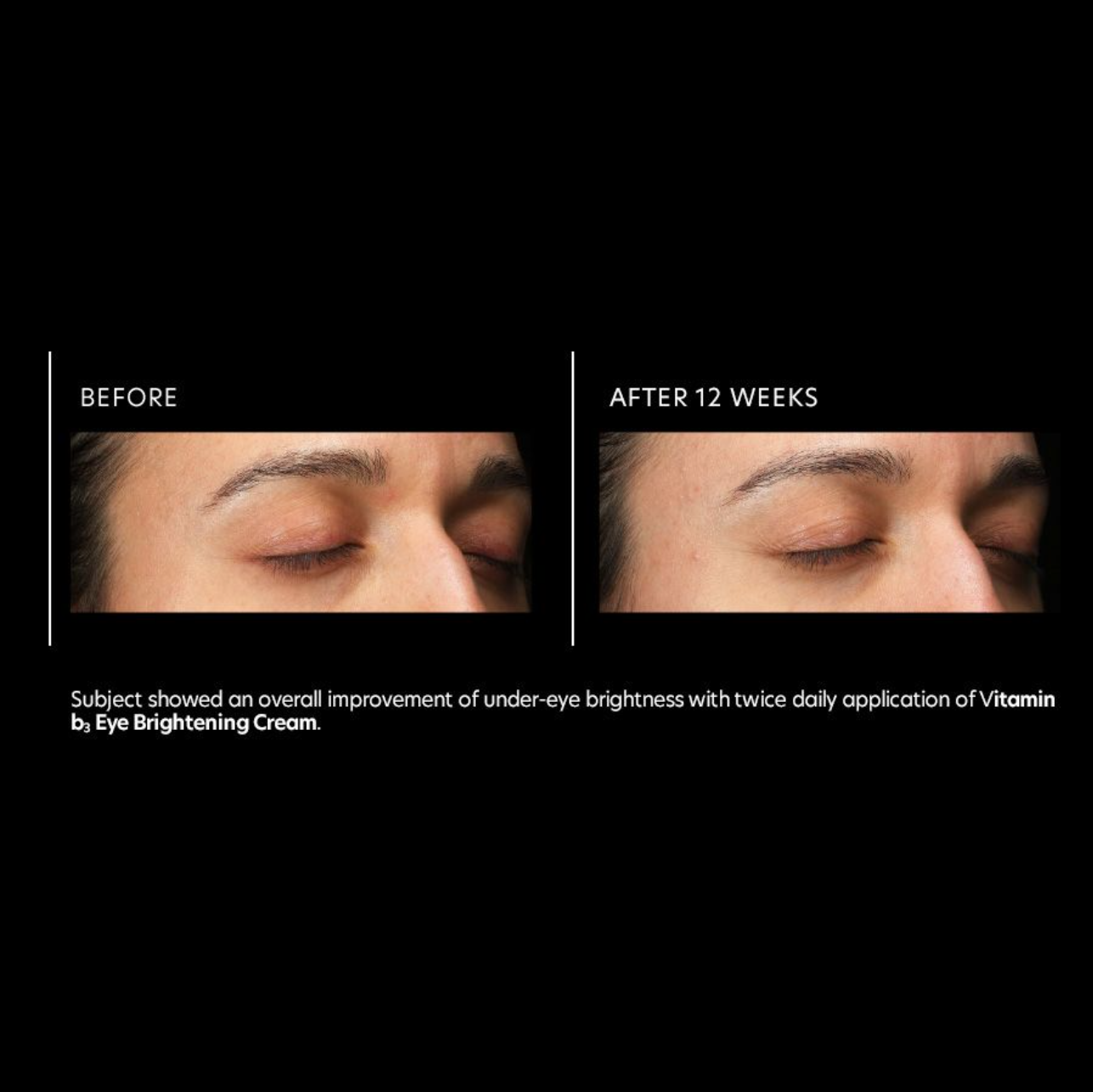Vitamin B3 Eye Brightening Cream