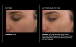 Intensive Clarity Treatment®: 0.5% pure retinol night