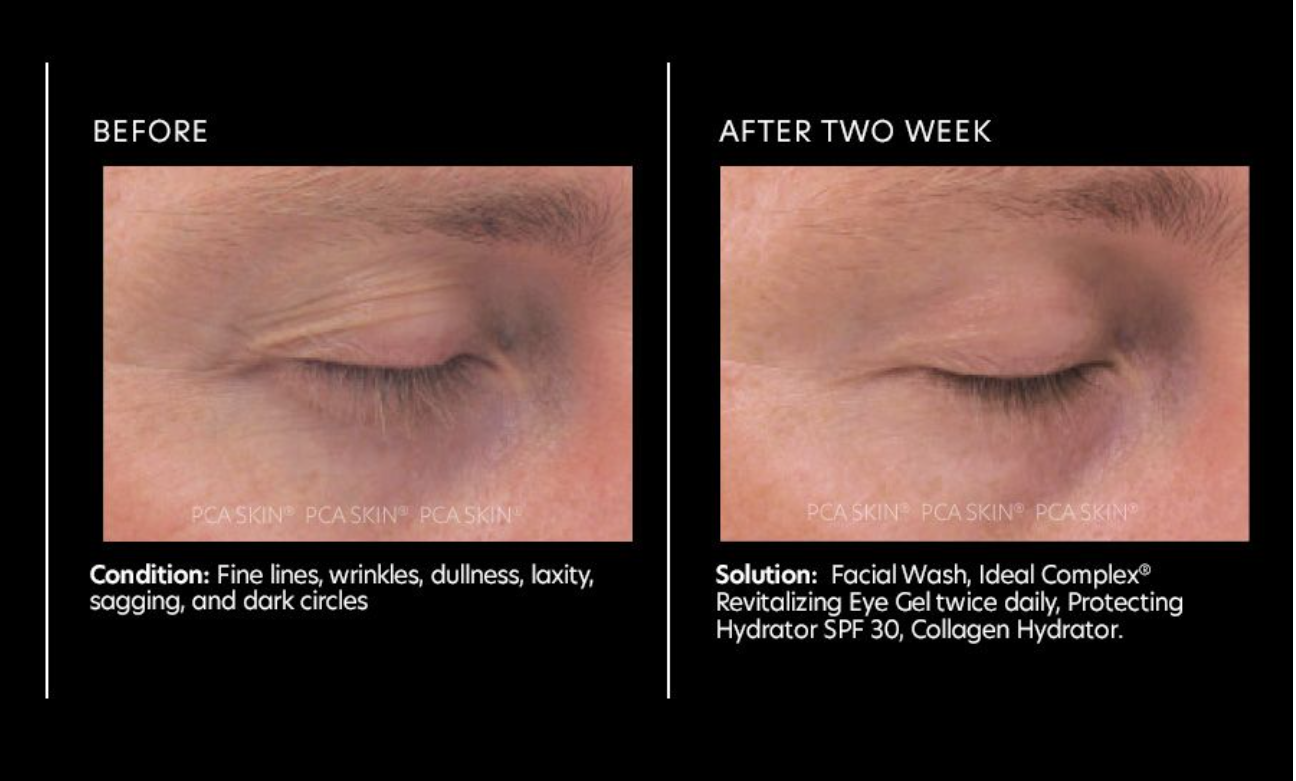 Ideal Complex: Revitalizing Eye Gel