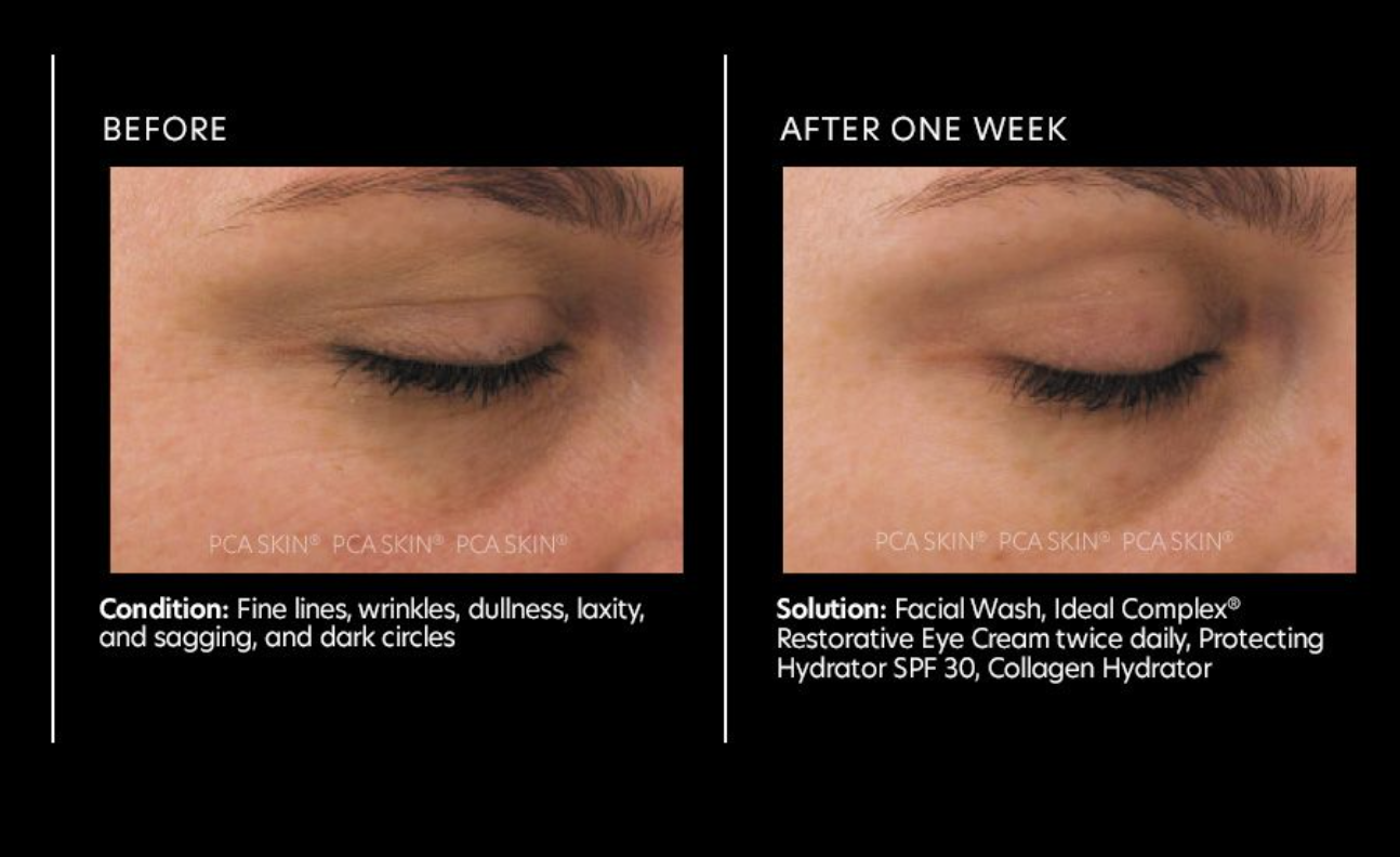 Ideal Complex Restorative Eye Cream