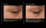 Ideal Complex Restorative Eye Cream