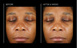 Hyaluronic Acid Overnight Mask