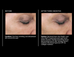 Rejuvenating Serum
